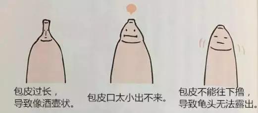 包皮到底要不要割？先搞懂這8個(gè)問題！